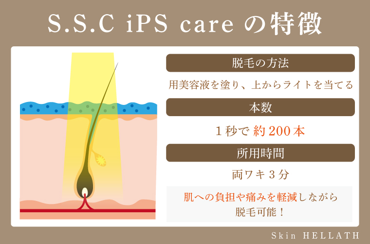 S.S.C　iPS　careの特徴